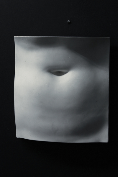 Stomach Cast